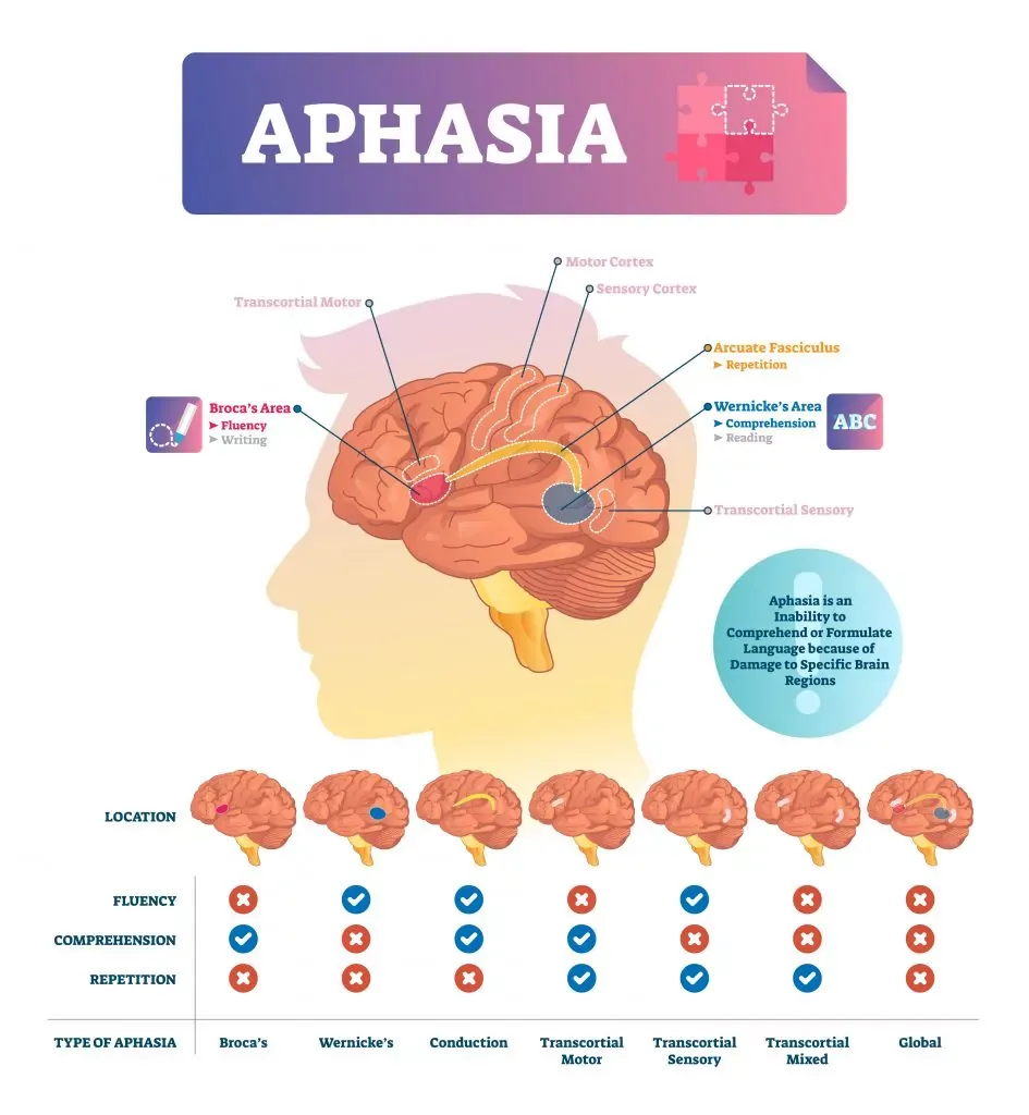 Aphasia-Types-of-language-Impediments-945x1024