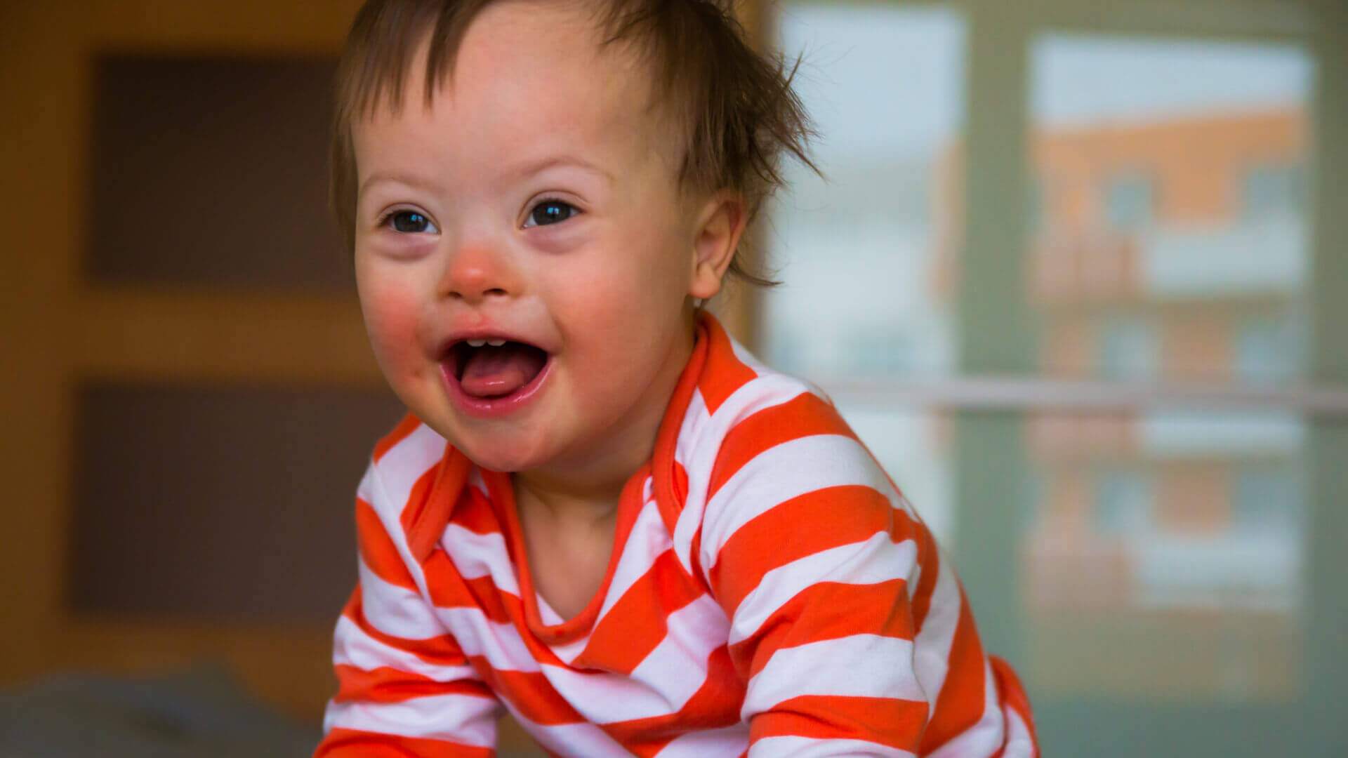 Child with Down syndrome (1)